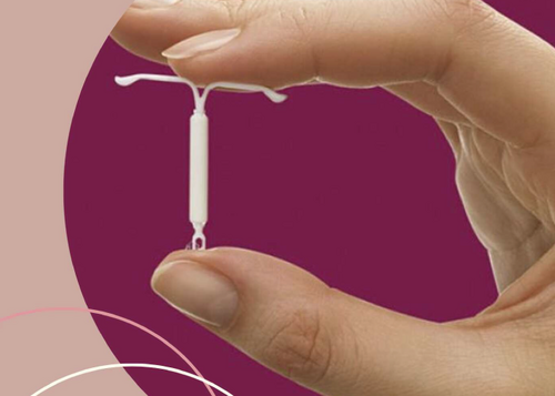 Colocación de dispositivo intrauterino Mirena